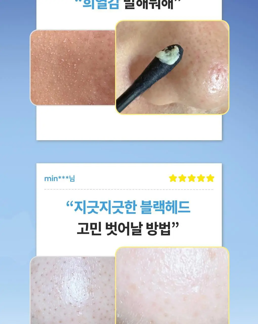 [2900만장판매/1등코팩] 일소 네추럴 마일드 클리어 노우즈 팩 10매 기획 상세페이지 12